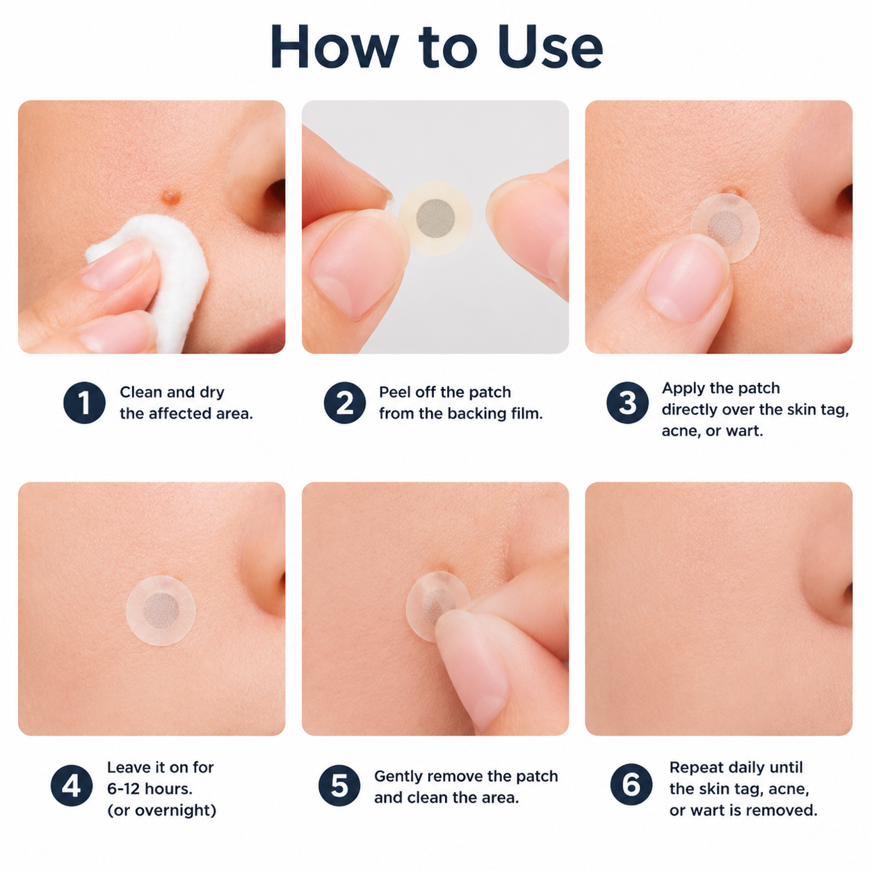 2-in-1 Microneedle & Hydrocolloid Skin Care Patches