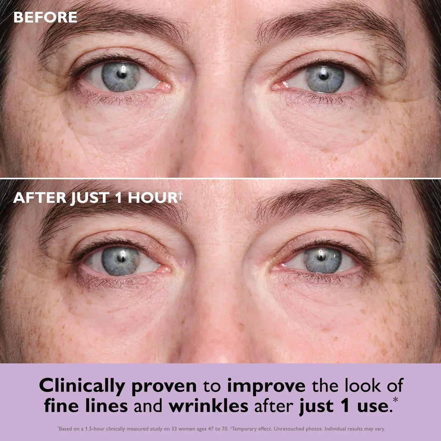 🌸Instant Collagen Infusion Tightening Eye Patches
