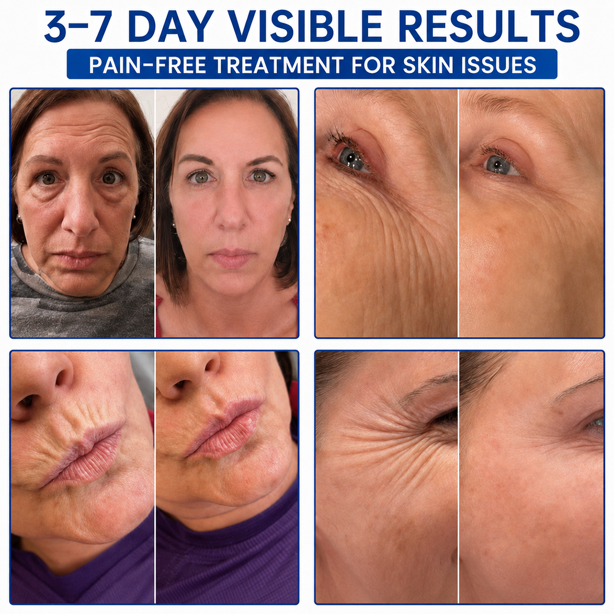PDRN Firming Facial Cream, For Smoother‑Looking Skin