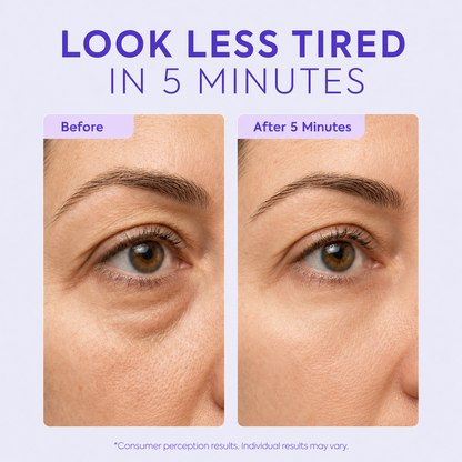 Instant Lift Eye Gel – Reduces the Look of Eye Bags