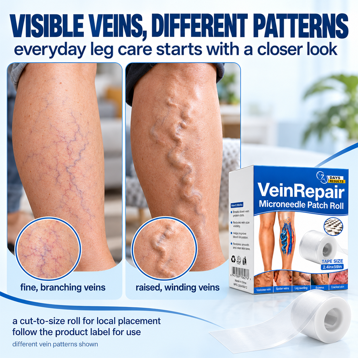 varicose vein patch