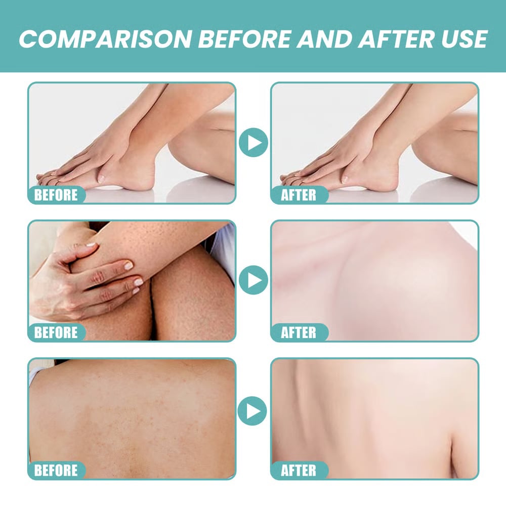 Skin So Soft Original Bath Oil - For Silky Smooth Skin & Natural Mosquito Protection!