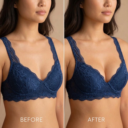 Breast Enhance Mentmicroneedle Patch