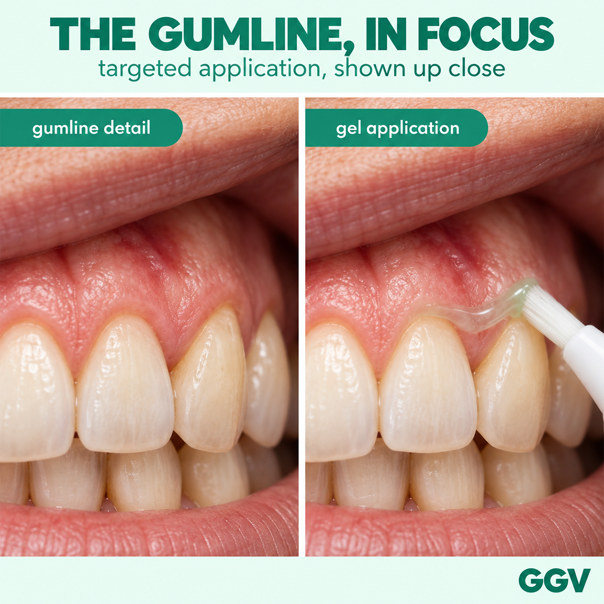 Gum Repair Gel