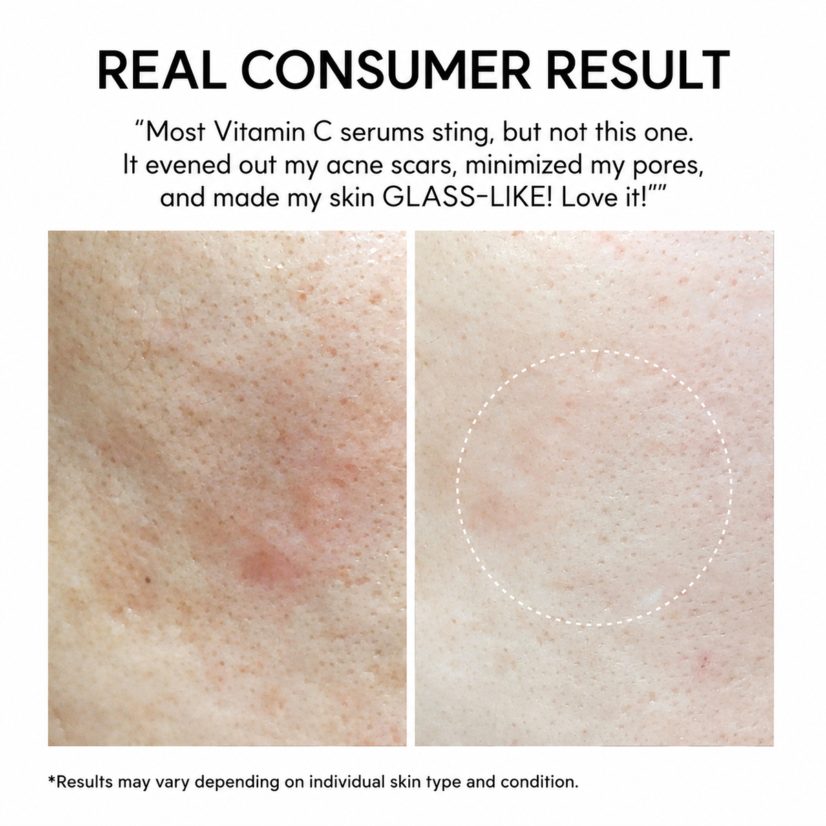 Vitamin C Glutathione Booster Shot Skin Serum
