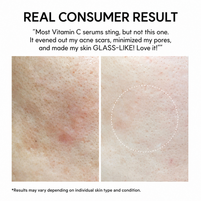 Vitamin C Glutathione Booster Shot Skin Serum