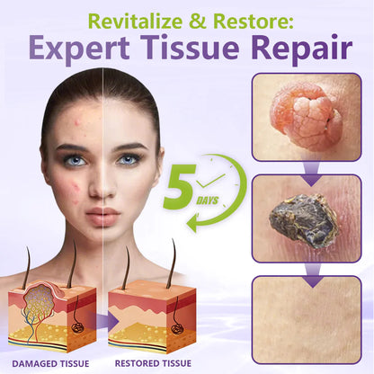 MicroNeedle Botanic Skin Tag Removal Patch