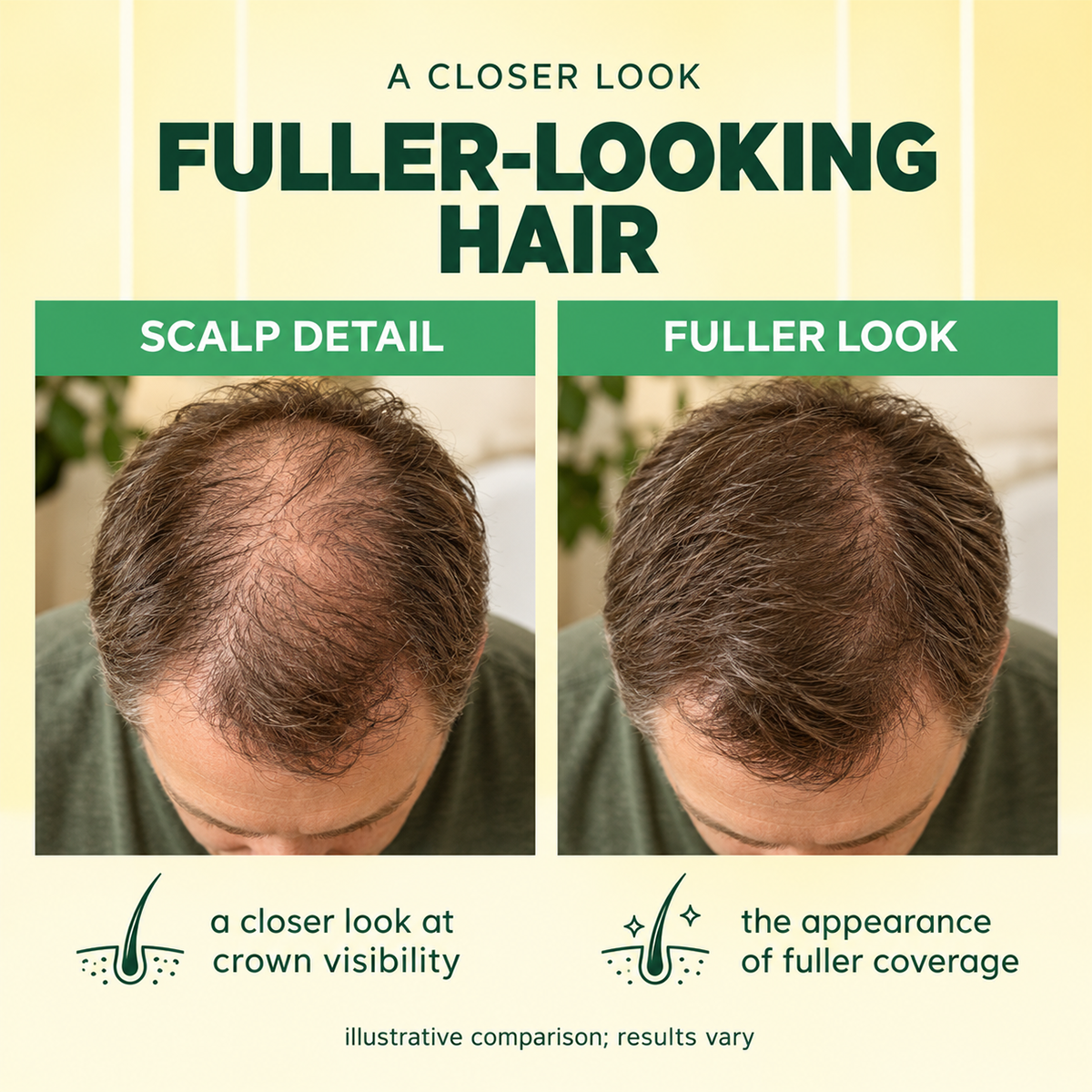 Microneedle Scalp Ampoule Serum, Hair Nourishing Care