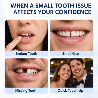 Temporary Tooth Replacement Kit