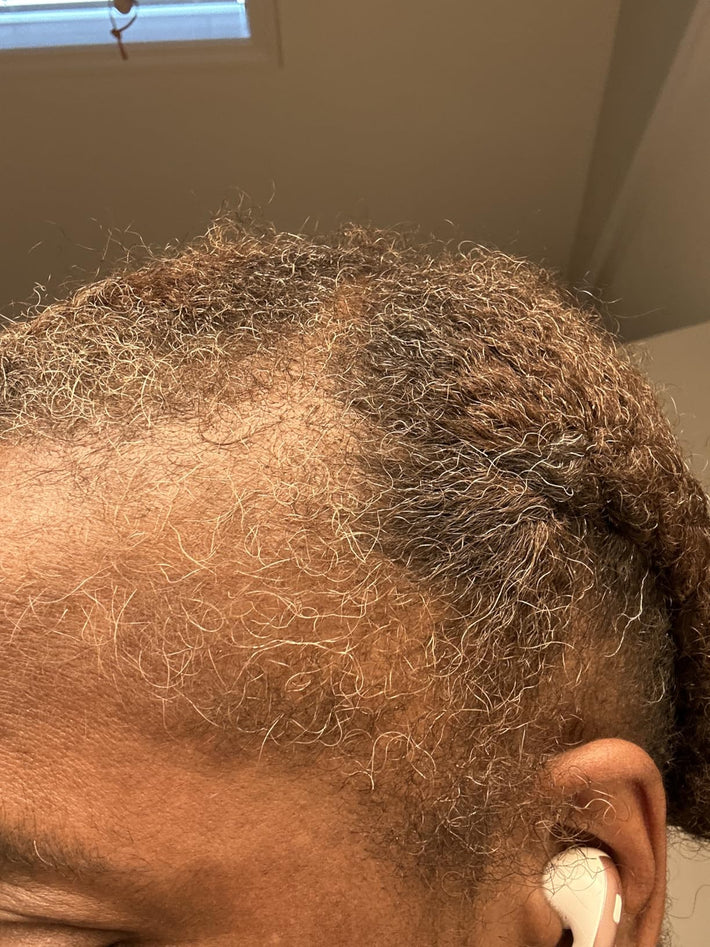 Customer hair result