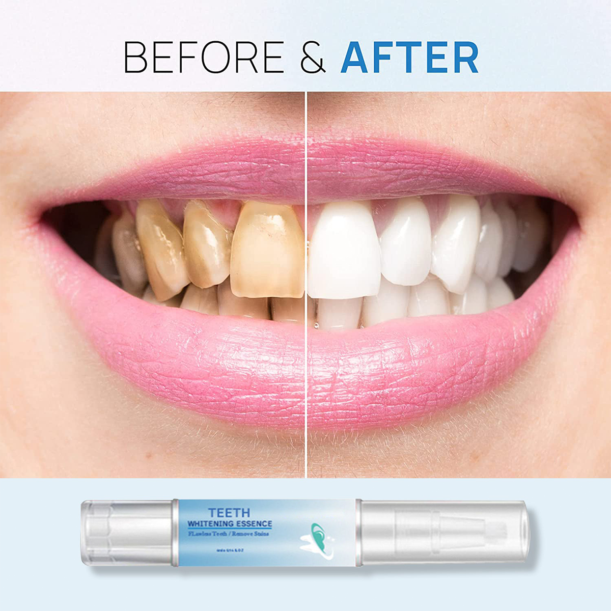 BUY 1 GET 1 FREE | Teeth Whitening Essence