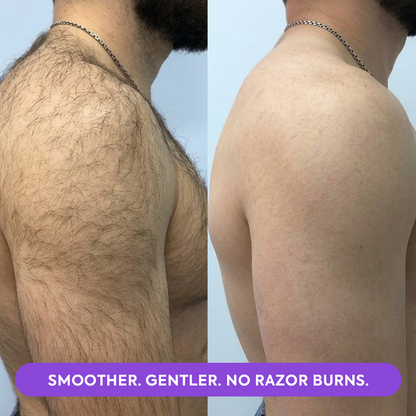 Hair Removal Mousse
