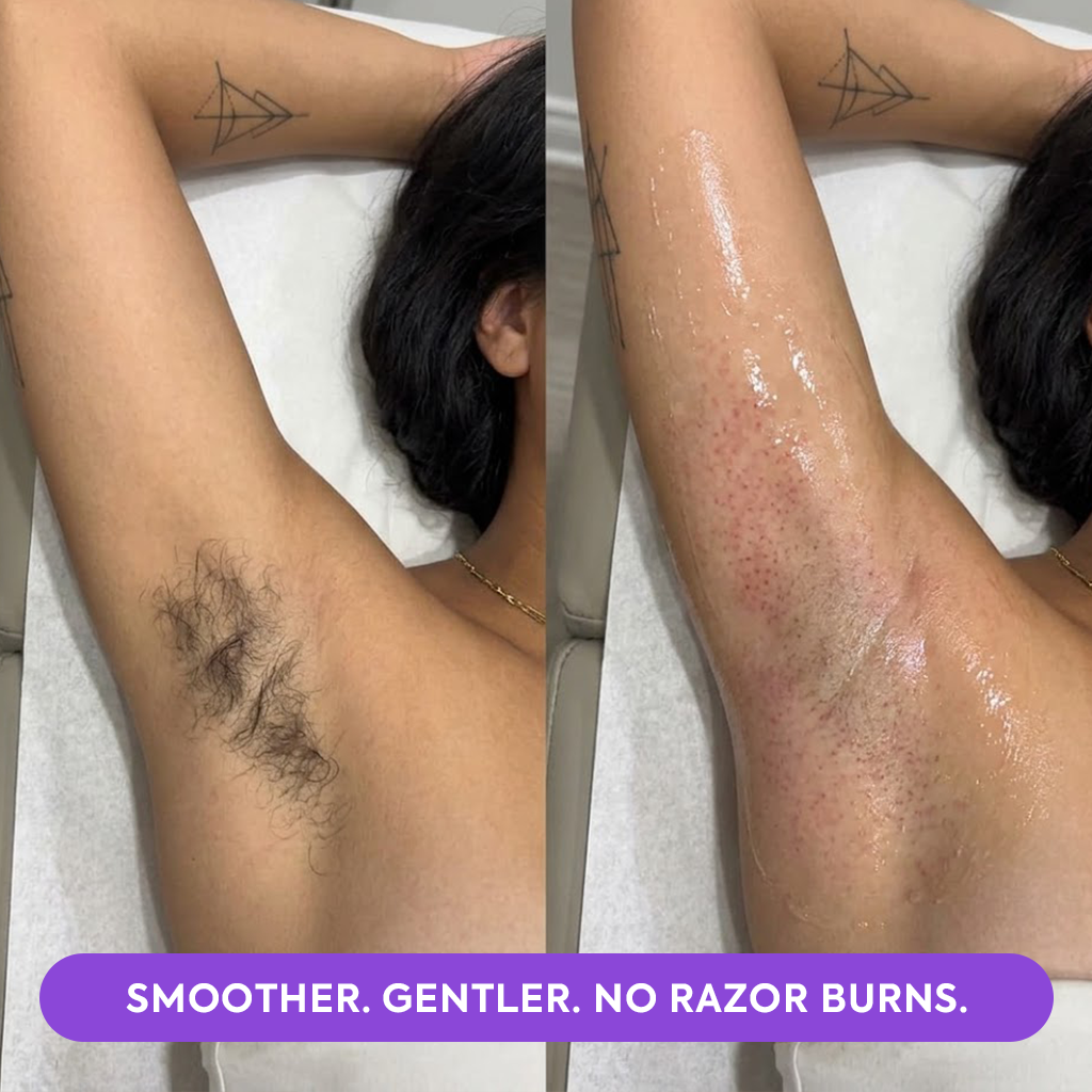 Hair Removal Mousse