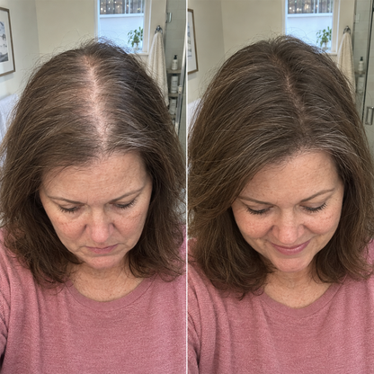 Hair Regrowth Spray