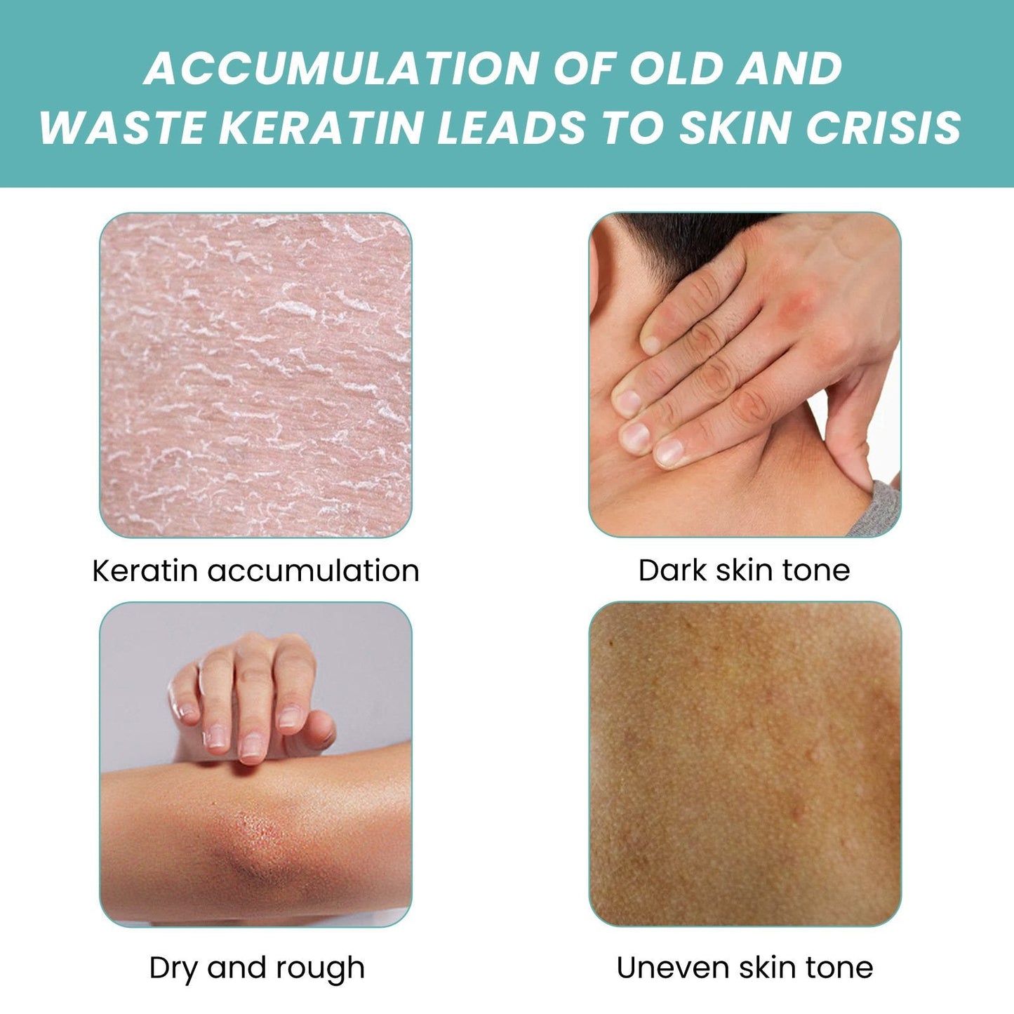 Skin So Soft Original Bath Oil - For Silky Smooth Skin & Natural Mosquito Protection!