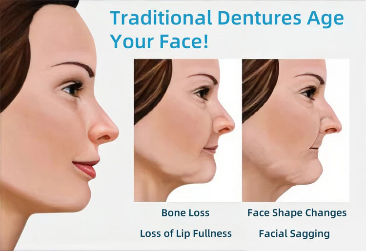 Traditional dentures age your face