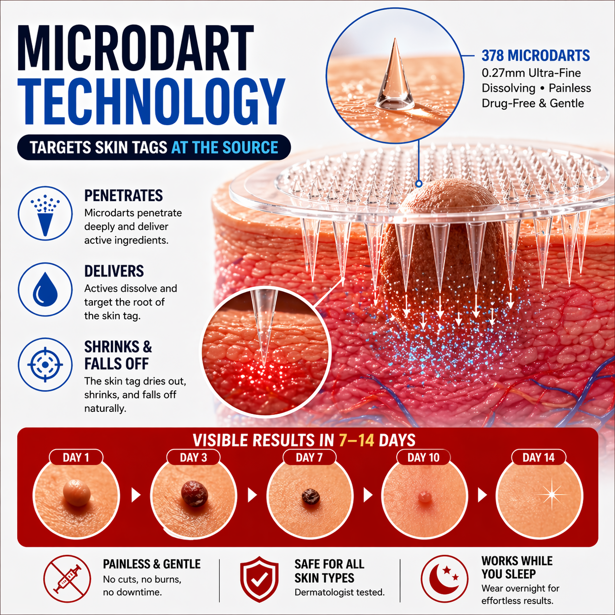 MicroNeedle Botanic Skin Tag Removal Patch