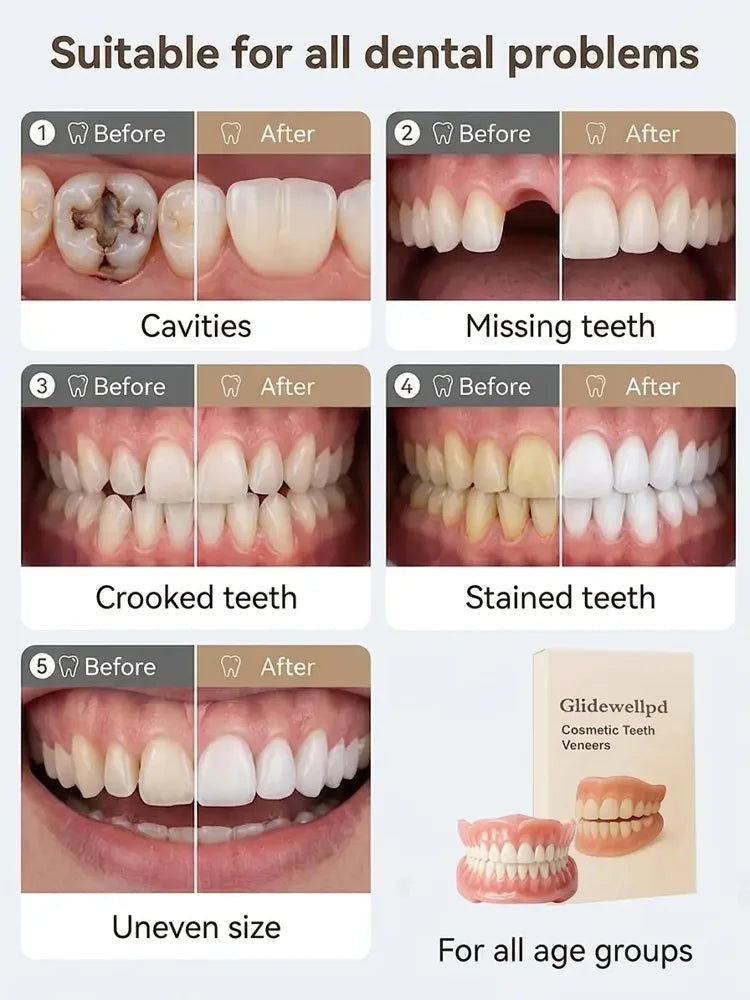 Fits Most Tooth Conditions