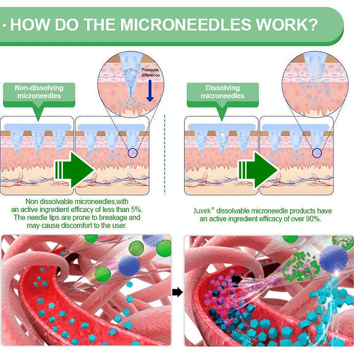 Dissolving Micro-Tip Patch Format