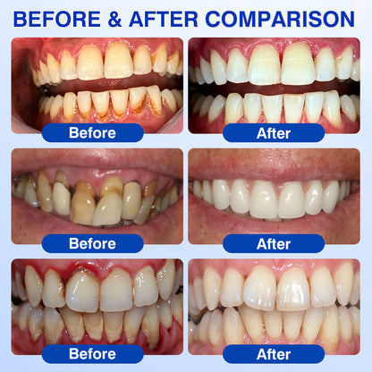 Before and after gum comparison set two