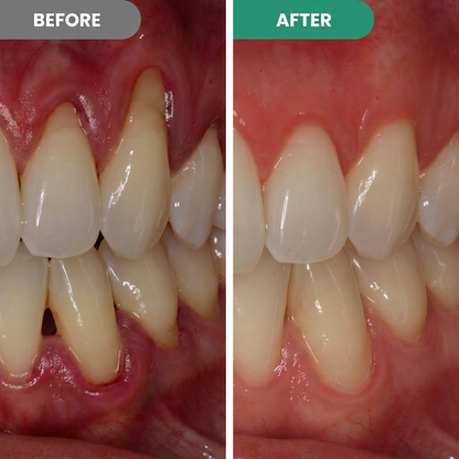 Gum Repair Gel
