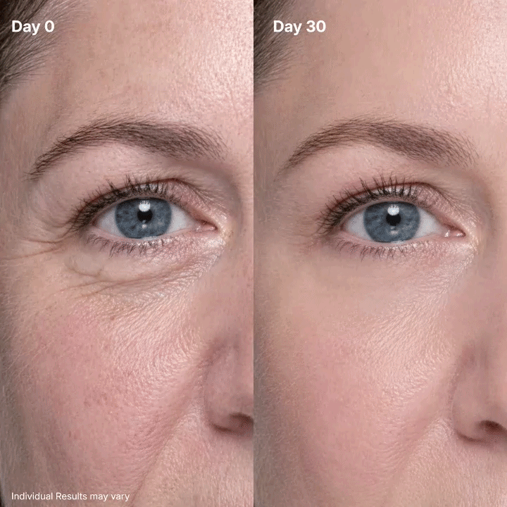 🔥P7 Eye Renewal Cream